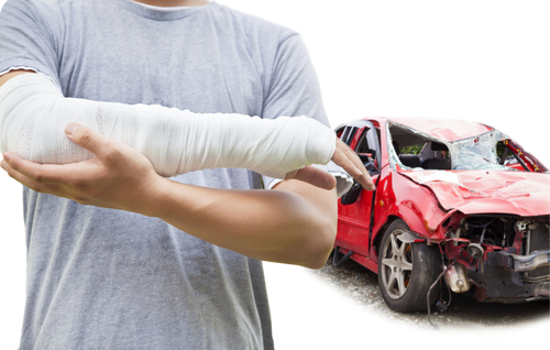 Car accident lawyer at Altman-Nussbaum-Shunnarah Trial Attorneys helping injured driver with broken arm after serious collision.
